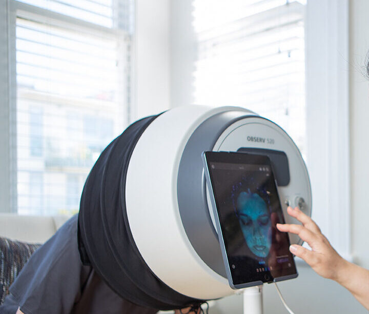 Skin Ritual  - Skin Assessment with Observ 520