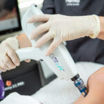 Scar Revision Treatment