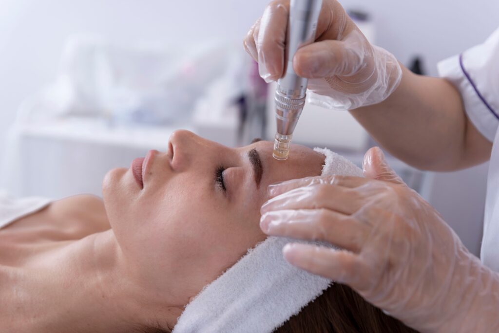 RF Dermal Needling