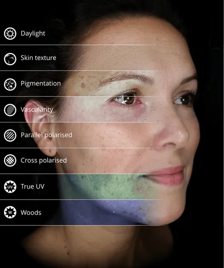 Skin Ritual  - Skin Assessment with Observ 520