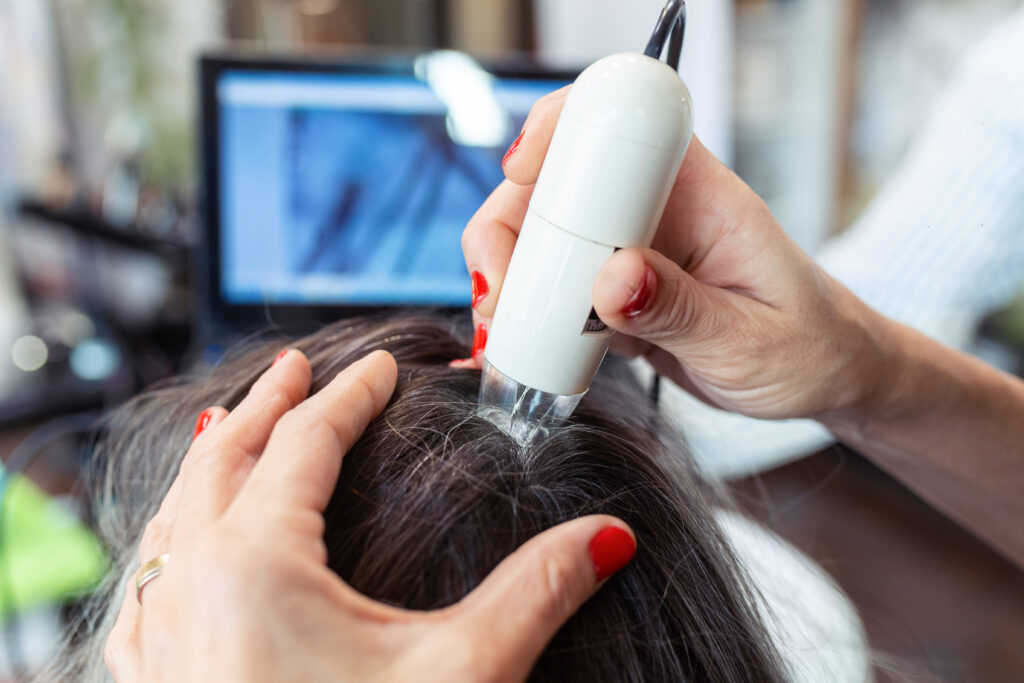 Hair Loss Consultation - Wellington