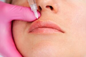 Lip Treatments