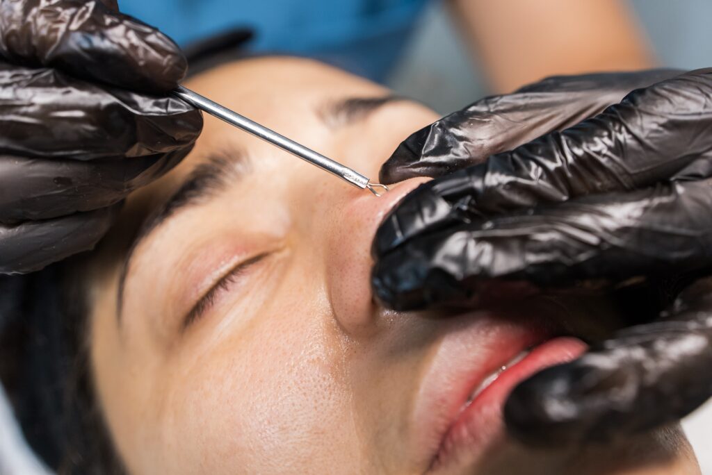 Facials